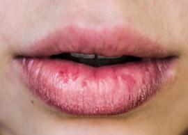 3 DIY Balms To Get Rid of Chapped Lips