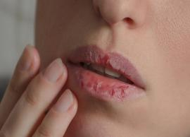 6 Simple Home Remedies To Treat Cut Lips
