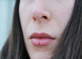 5 Remedies To Get Rid of Chapped Lips