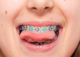 5 Ways To Get Your Child Ready for Braces