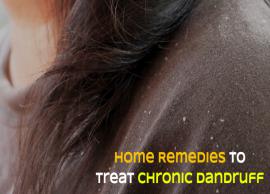 Home Remedies To Help You Treat Chronic Dandruff