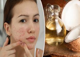4 DIY Ways To Use Coconut Oil To Treat Acne Scars
