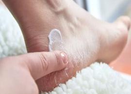 10 Home Remedies To Treat Cracked Heels