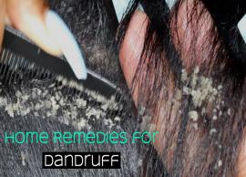 5 Easy Home Remedies To treat Dandruff Problem