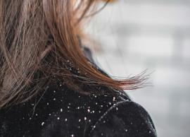 5 Home Remedies To Treat Dandruff During Winters