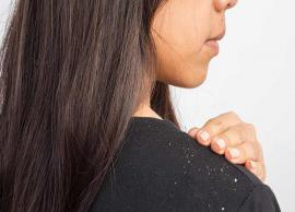 7 Amazing Home Remedies To Cure Dandruff
