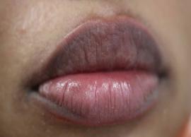 6 Effective Home Remedies To Get Rid of Black Lips