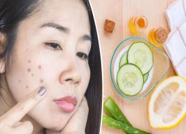 6 Home Remedies That Will Help You Get Rid of Dark Spots