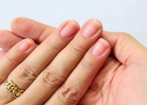 5 Ways To Treat Discolored Nails