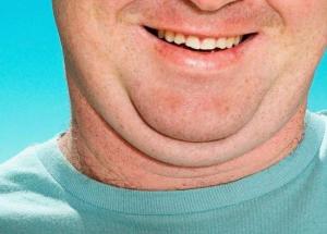 5 Easy Ways To Get Rid of Double Chin