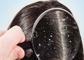 6 Quick Remedies To Help You Treat Dandruff