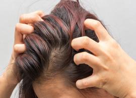 5 Home Remedies To Treat Dry Itchy Scalp