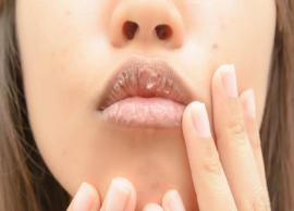 5 Effective Homemade Tips To Treat Dry Lips