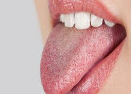 6 Home Remedies To Treat Dry Mouth