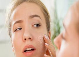 6 Effective Natural Remedies To Get Rid of Dry Skin
