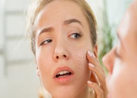 4 Effective Remedies People With Dry Skin Should Follow