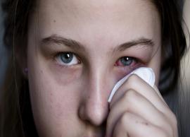 6 Best Remedies To Treat Eye Infection at Home