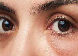 10 DIY Ways To Get Rid of Eye Puffiness