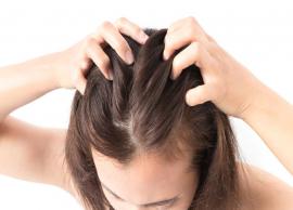 5 Easy Ways To Get Rid of Flaky Scalp