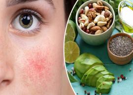 5 Skin Issues That Can Be Healed With Food