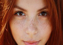 5 Home Remedies To Get Rid of Freckles