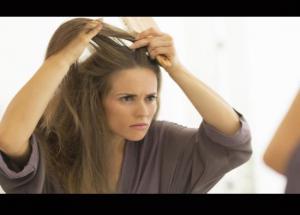 Step By Step Guide To Avoid Dandruff During Winters