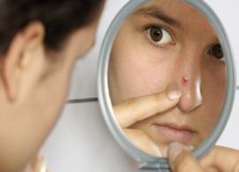 5 Easiest Ways To Get Rid of Pimples Quickly