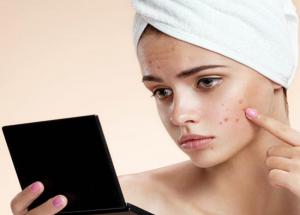 5 Fastest Working Tricks To Get Rid of Pimples Overnight