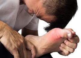 5 Home Remedies To Treat Gout Pain