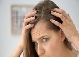 5 Common Herbal Ways To Prevent Hair Loss