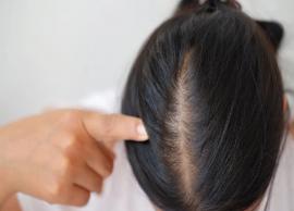10 Home Remedies To Help You Treat Hair Fall