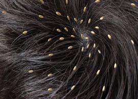 Home Remedies to Get Rid of Hair Lice
