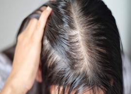 5 Natural Ways To Control Hair Thinning Hormones