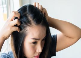 3 Powerful Home Remedies for Hair Thinning