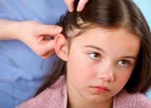 5 Cheap Ways To Treat Head Lice