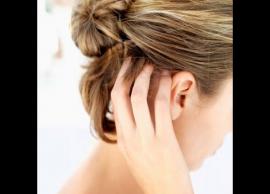 5 Home Remedies To Get Rid of Itchy Scalp