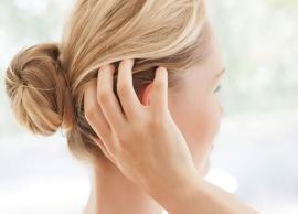 5 Home Remedies To Treat Itchy Scalp