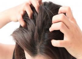 9 Home Remedies That are Effective To Treat Itchy Scalp