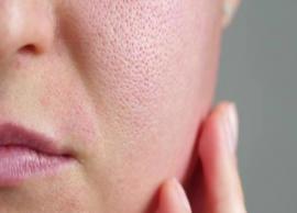 5 Effective Remedies for Large Pores on Face