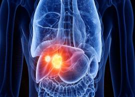 10 Home Remedies That are Helpful in Preventing Liver Cancer