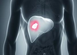 8 Home Remedies to Prevent Liver Cancer