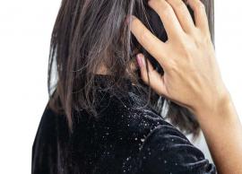 4 Tips To Help You Prevent Monsoon Dandruff