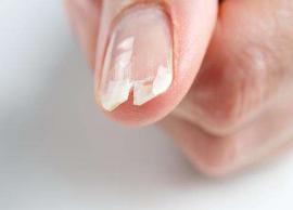 3 Easy Home Remedies To Get Rid of Brittle and Chipped Nails