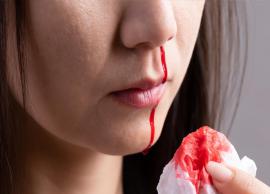 9 Ways To Treat Nosebleeds at Home