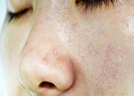 10 DIY Moisturizers To Treat Oily Skin