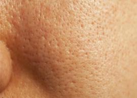 5 Home Remedies To Tighten Open Pores on Skin