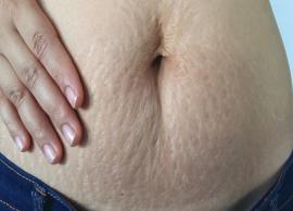 Reduce The Appearance of Pregnancy Stretch Marks Through Simple Homemade Treatments