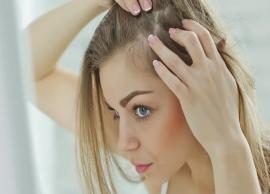 6 Common Reasons That are Leasing To Hair Loss