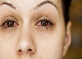 5 Remedies To Treat Itching in The Eyes at Home
