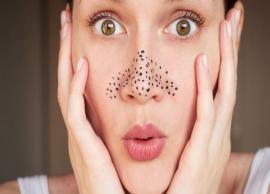 5 Home Remedies To Get Rid of Blackheads